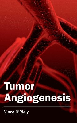 Tumor Angiogenesis 1