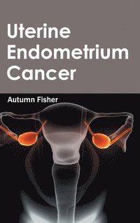 bokomslag Uterine Endometrium Cancer