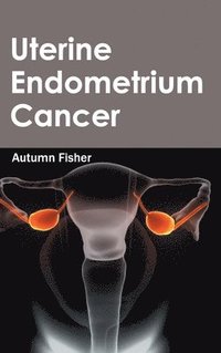 bokomslag Uterine Endometrium Cancer