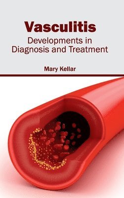 Vasculitis: Developments in Diagnosis and Treatment 1