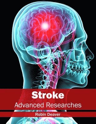 bokomslag Stroke: Advanced Researches