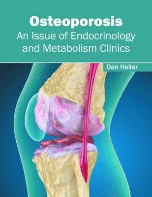 bokomslag Osteoporosis: An Issue of Endocrinology and Metabolism Clinics