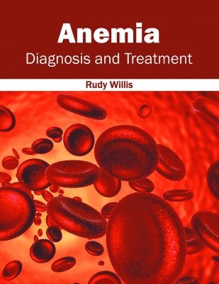 Rudy Willis - Anemia: Diagnosis and Treatment, Inbunden