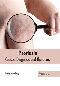bokomslag Psoriasis: Causes, Diagnosis and Therapies