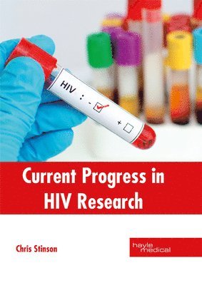 Chris Stinson - Current Progress in HIV Research, Inbunden