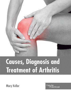 Causes, Diagnosis and Treatment of Arthritis 1