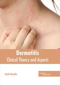 bokomslag Dermatitis: Clinical Theory and Aspects