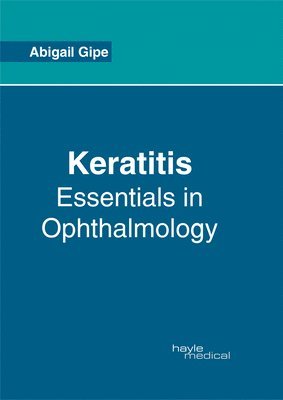Keratitis: Essentials in Ophthalmology 1