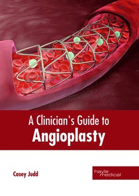Casey Judd - Clinician's Guide to Angioplasty, Inbunden
