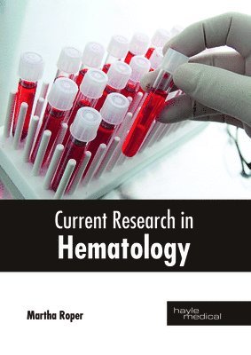 Current Research in Hematology 1