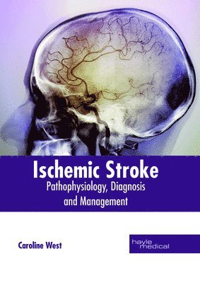 bokomslag Ischemic Stroke: Pathophysiology, Diagnosis and Management