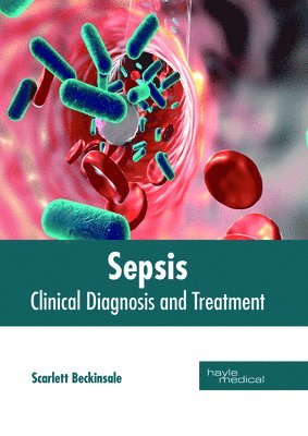 Sepsis: Clinical Diagnosis and Treatment 1