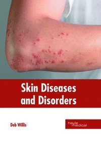 bokomslag Skin Diseases and Disorders