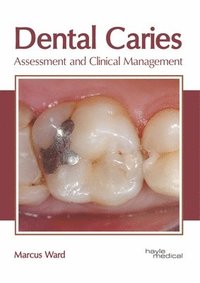 bokomslag Dental Caries: Assessment and Clinical Management