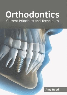 Orthodontics: Current Principles and Techniques 1