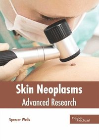 bokomslag Skin Neoplasms: Advanced Research