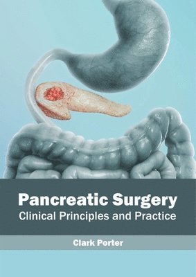 Pancreatic Surgery: Clinical Principles and Practice 1