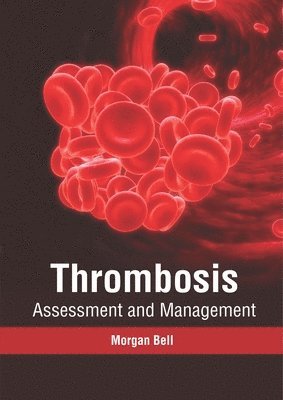 bokomslag Thrombosis: Assessment and Management