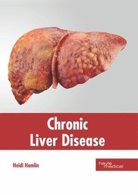 bokomslag Chronic Liver Disease