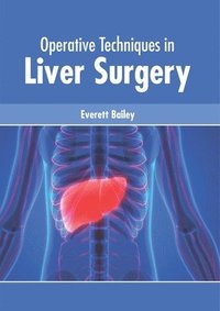 bokomslag Operative Techniques in Liver Surgery