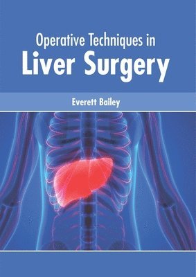 bokomslag Operative Techniques in Liver Surgery