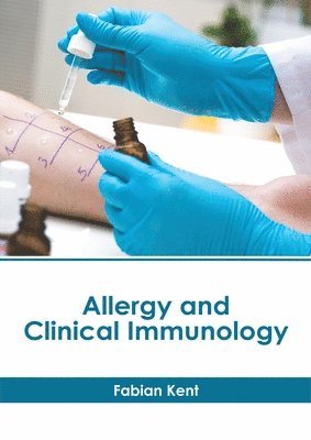 Fabian Kent - Allergy and Clinical Immunology, Inbunden
