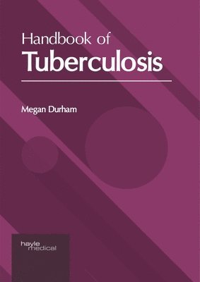 bokomslag Handbook of Tuberculosis