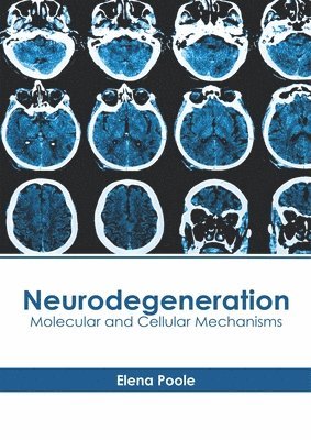 Neurodegeneration: Molecular and Cellular Mechanisms 1