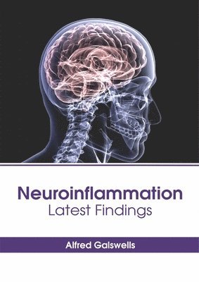 Neuroinflammation: Latest Findings 1