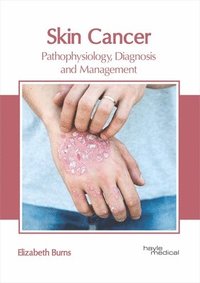 bokomslag Skin Cancer: Pathophysiology, Diagnosis and Management