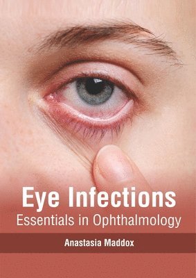 Anastasia Maddox - Eye Infections: Essentials in Ophthalmology, Inbunden
