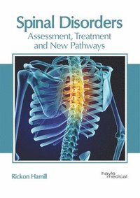 bokomslag Spinal Disorders: Assessment, Treatment and New Pathways