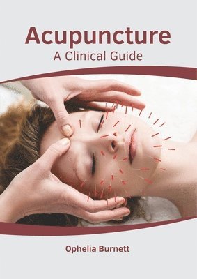 Acupuncture: A Clinical Guide 1