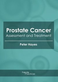 bokomslag Prostate Cancer: Assessment and Treatment