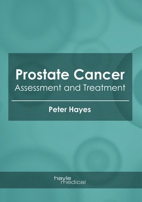 Prostate Cancer: Assessment and Treatment 1