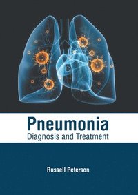 bokomslag Pneumonia: Diagnosis and Treatment