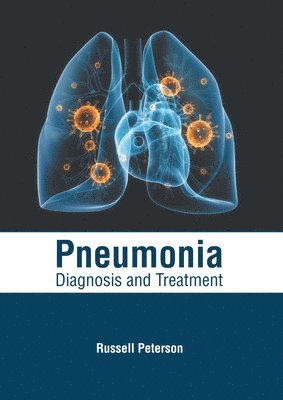 Russell Peterson - Pneumonia: Diagnosis and Treatment, Inbunden