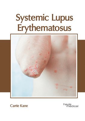 bokomslag Systemic Lupus Erythematosus