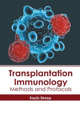 Kayla Streep - Transplantation Immunology: Methods and Protocols, Inbunden