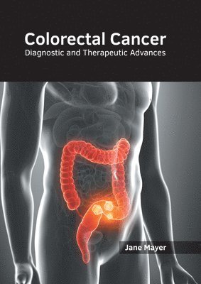 bokomslag Colorectal Cancer: Diagnostic and Therapeutic Advances