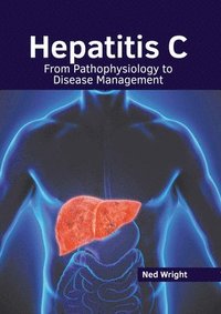 bokomslag Hepatitis C: From Pathophysiology to Disease Management