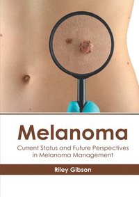 bokomslag Melanoma: Current Status and Future Perspectives in Melanoma Management