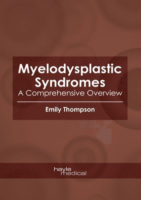 Emily Thompson - Myelodysplastic Syndromes: A Comprehensive Overview, Inbunden
