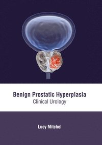 bokomslag Benign Prostatic Hyperplasia: Clinical Urology