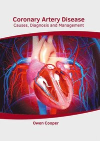 bokomslag Coronary Artery Disease: Causes, Diagnosis and Management