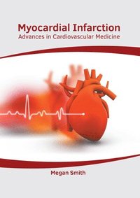 bokomslag Myocardial Infarction: Advances in Cardiovascular Medicine