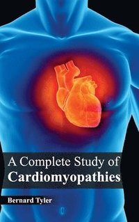 bokomslag Complete Study of Cardiomyopathies