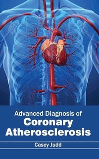 bokomslag Advanced Diagnosis of Coronary Atherosclerosis