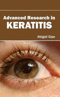 bokomslag Advanced Research in Keratitis