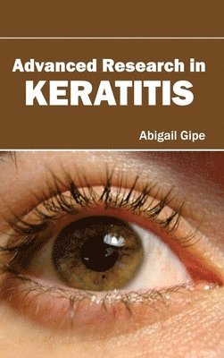 Advanced Research in Keratitis 1